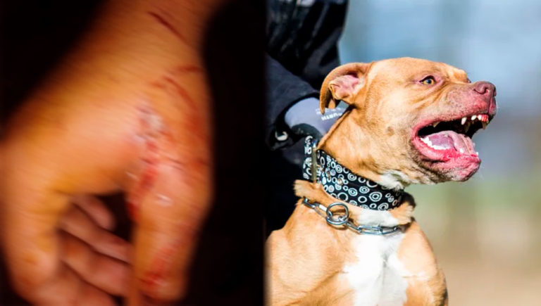 Un Pitbull Le Arranc El Brazo A Un Ladr N Y Piden Sacrificarlo Radio